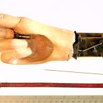 Main articulée avant restauration