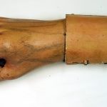 Main articulée après restauration